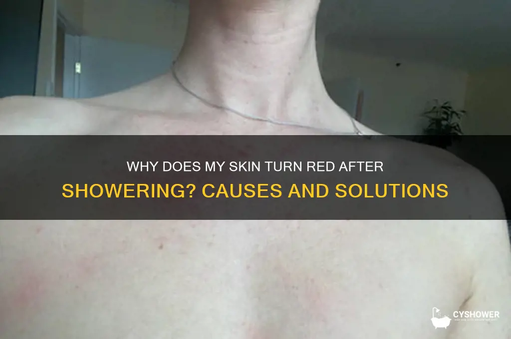 when i take a shower my skin turns red