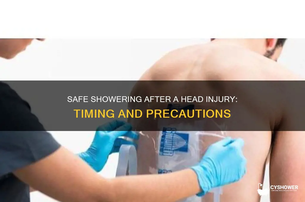 when is it safe to shower after a head wound