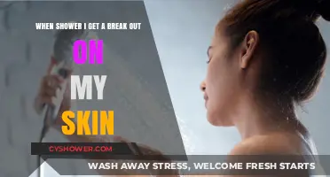 Shower Breakouts: Understanding and Preventing Skin Irritation After Bathing