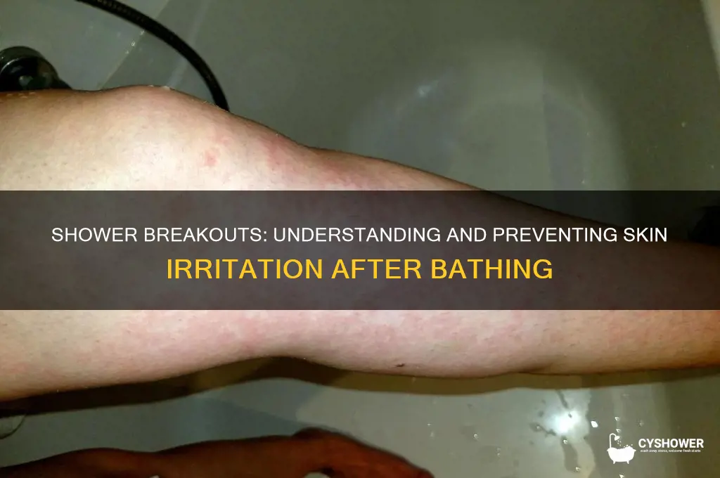 when shower i get a break out on my skin