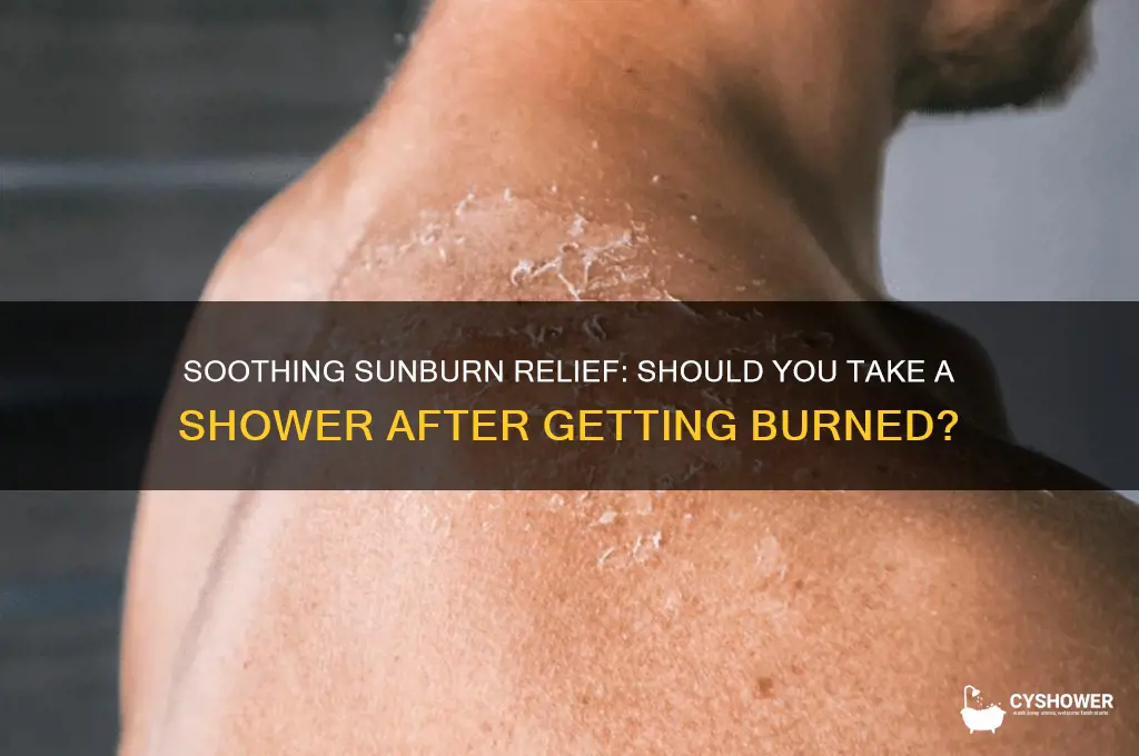 when sunburn take a shower