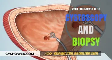 Post-Cystoscopy and Biopsy Shower Guidelines: Timing and Tips for Recovery