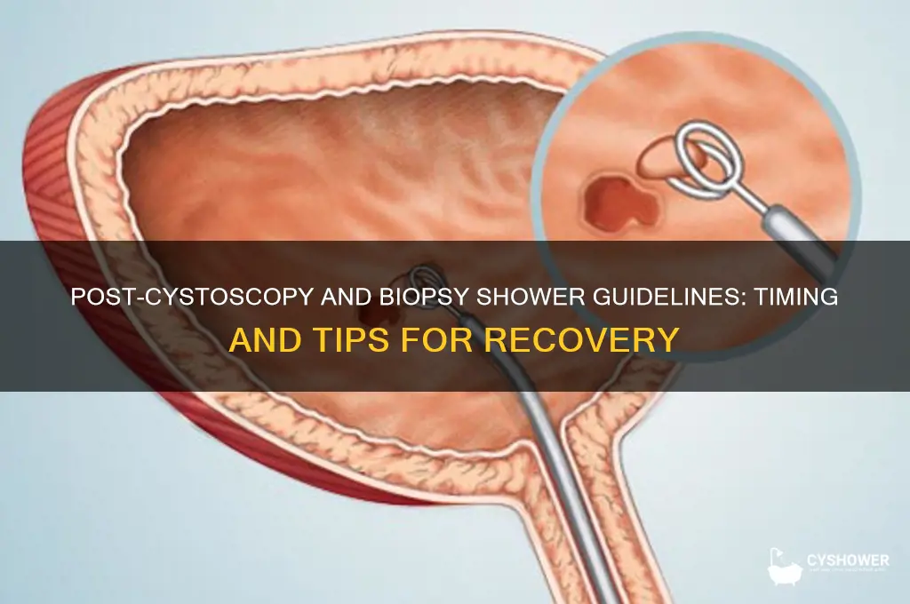when take shower after cystoscopy and biopsy