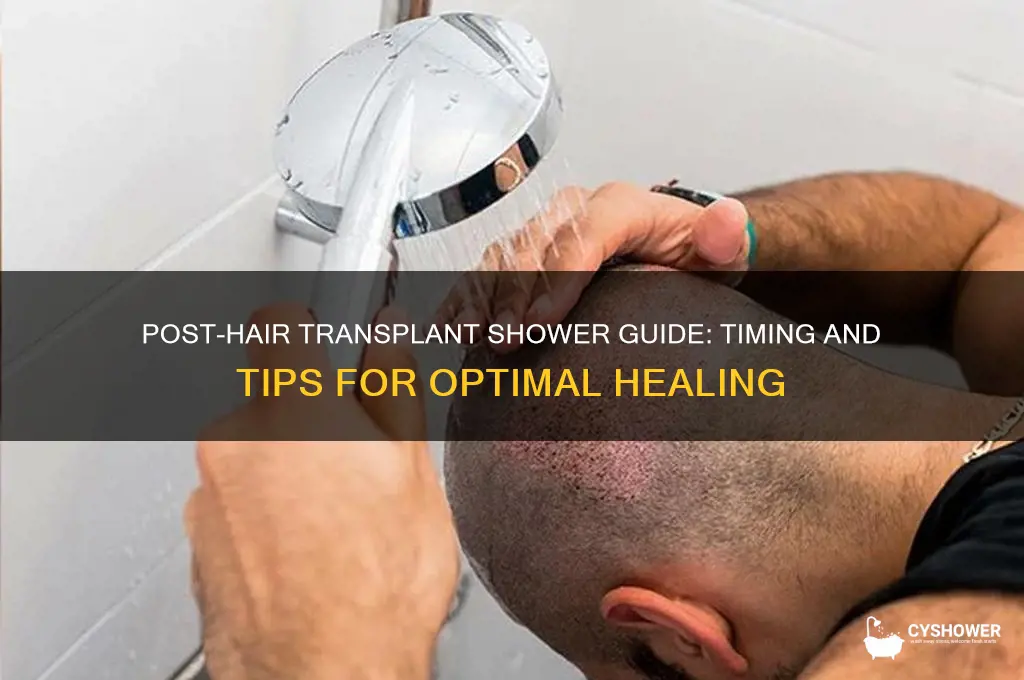 when to shower after hair transplant