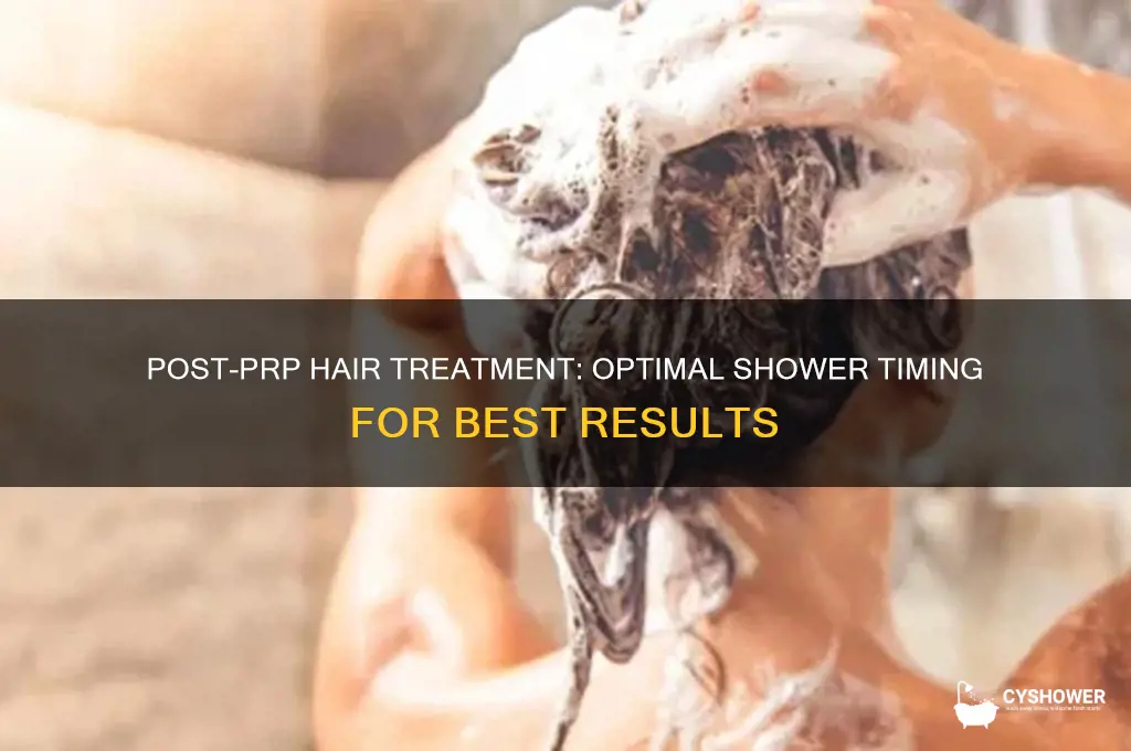 when to shower after prp hair