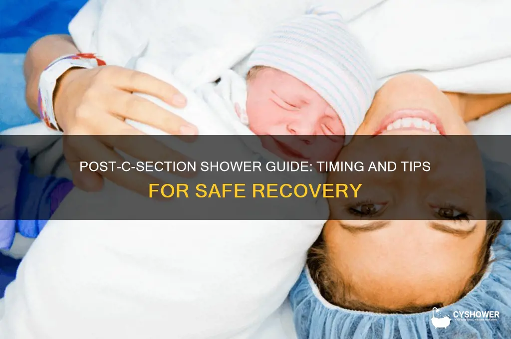 when to take a shower after c section