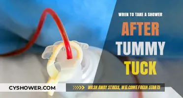 Post-Tummy Tuck Shower Guide: Timing and Tips for Safe Recovery