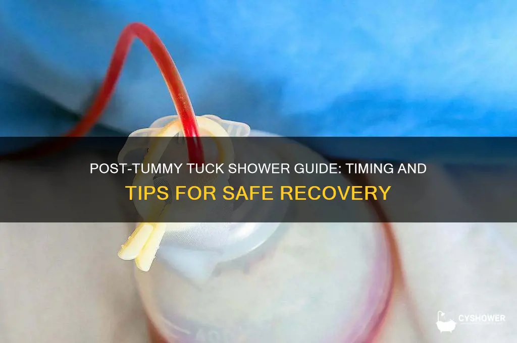 when to take a shower after tummy tuck