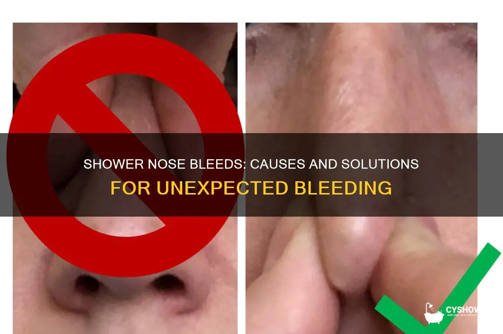 why am i getting nose bleeds in the shower