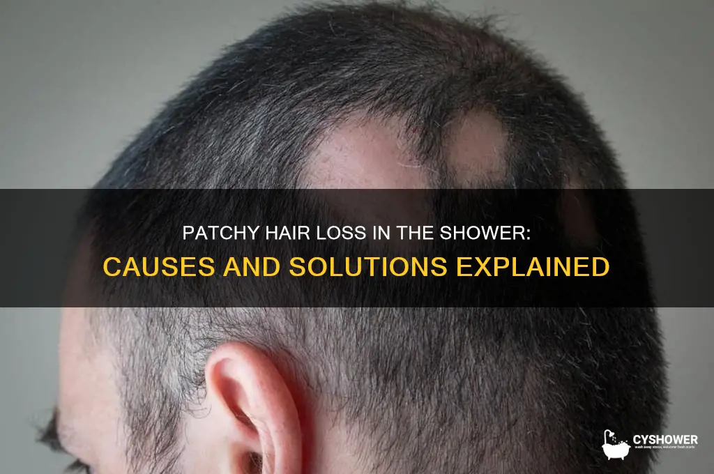 why am i losing patches of hair during ny shower