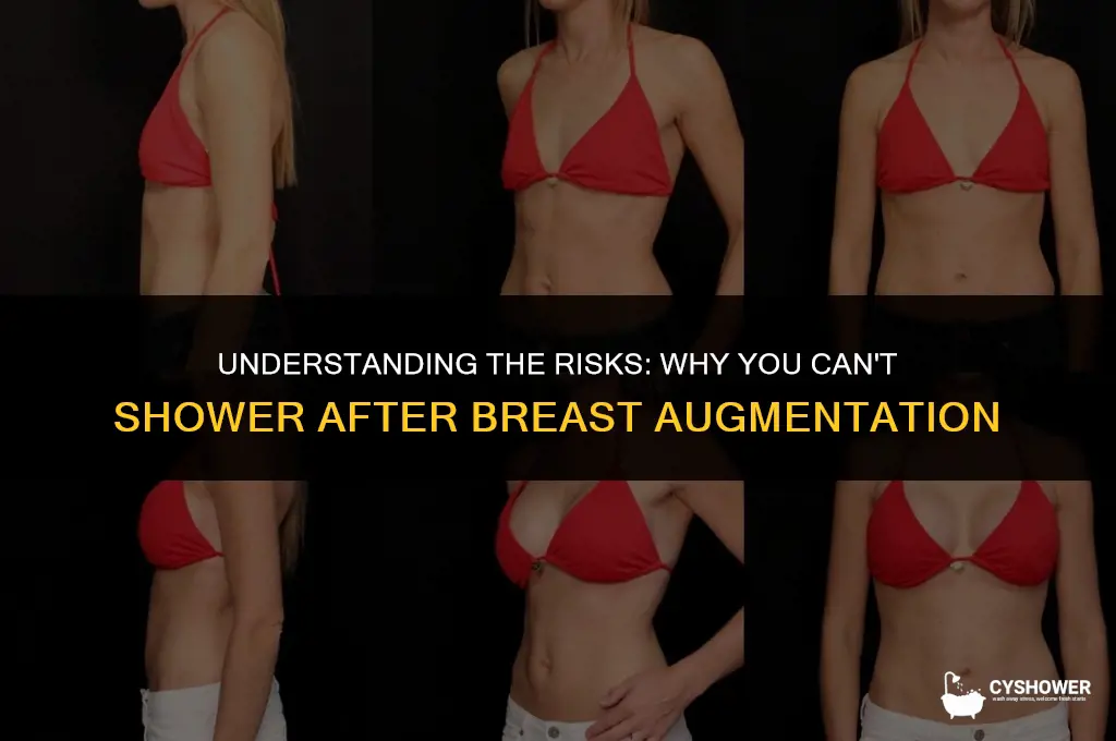 why can t i shower after breast augmentation