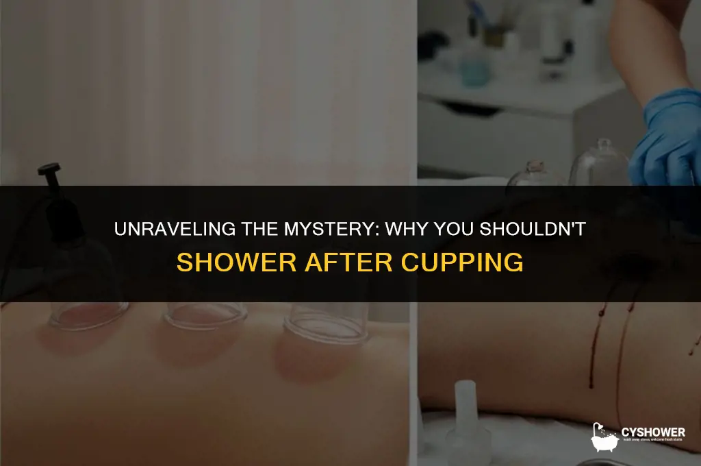 why can t i shower after cupping
