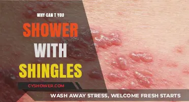 Understanding Shingles: Why You Should Avoid Showering During an Outbreak