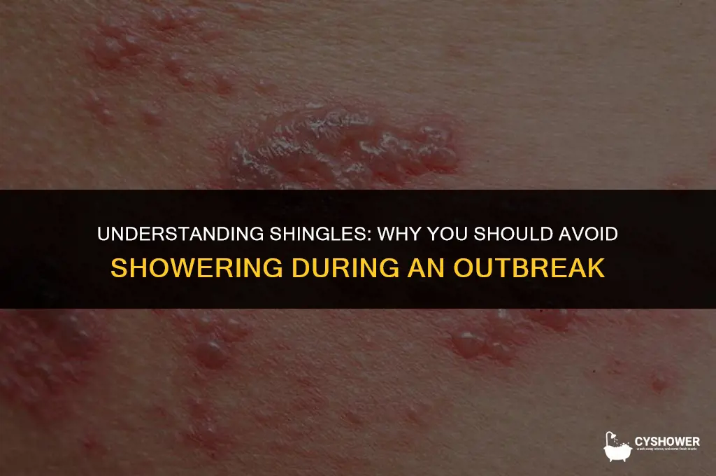 why can t you shower with shingles