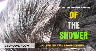 Post-Shower Dandruff: Causes and Quick Fixes for Flaky Scalp