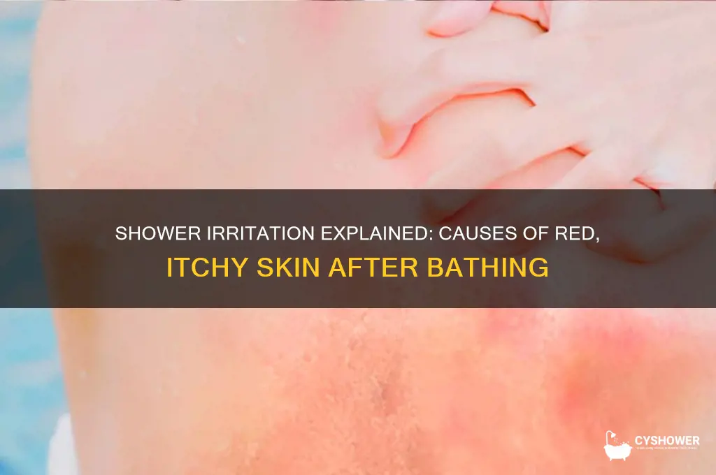 why did i get red and itchy from a shower
