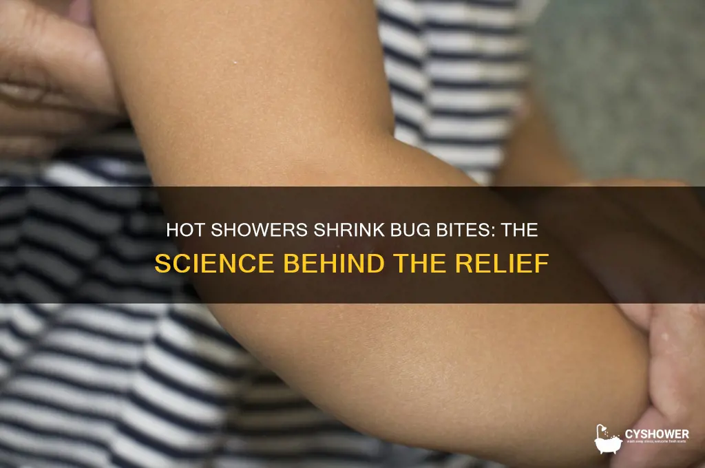 why do bug bites get smaller after a hot shower