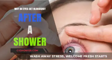 Why Do Eyes Get Bloodshot After a Shower? Explained
