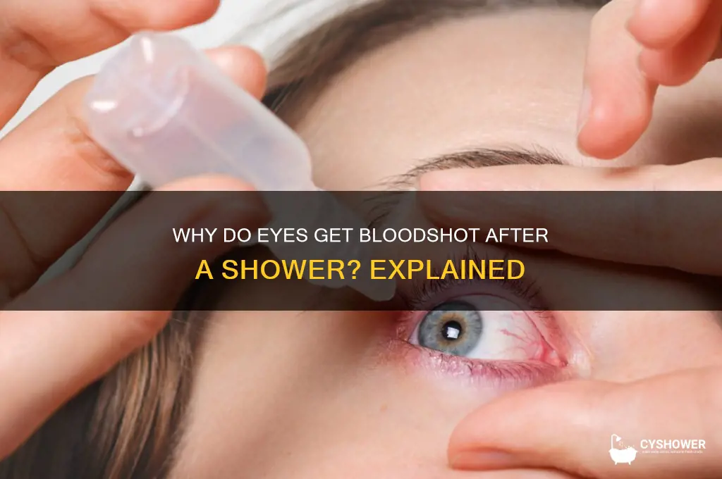 why do eyes get bloodshot after a shower