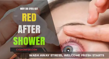 Why Do Eyes Turn Red After Showering? Explained Simply