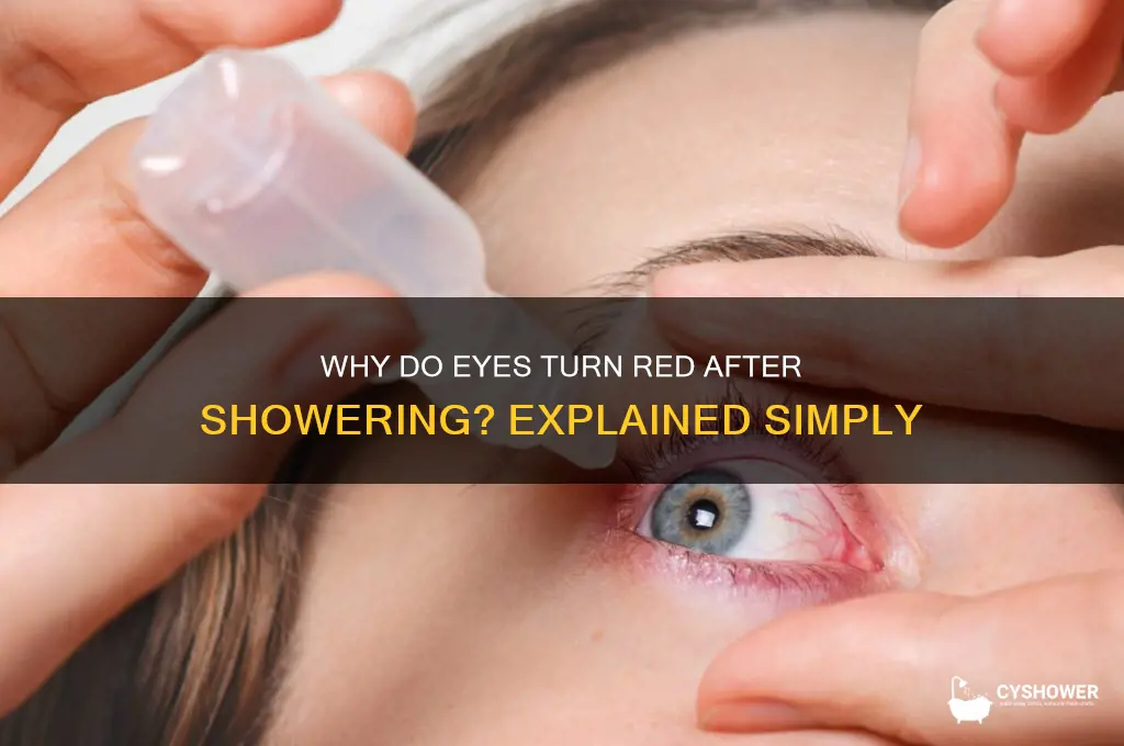 why do eyes get red after shower