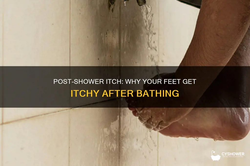 why do feet get itchy after shower