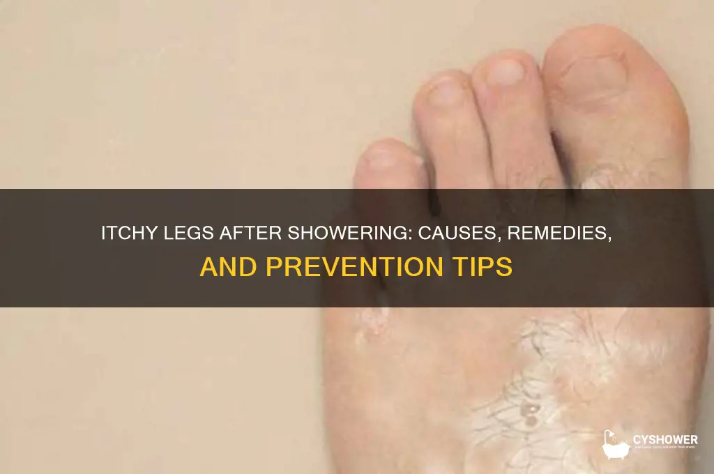 why do i always get itchy legs after a shower