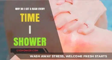 Shower Rashes Explained: Causes and Solutions for Sensitive Skin