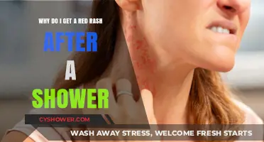 Post-Shower Red Rash: Causes, Prevention, and Soothing Solutions Explained