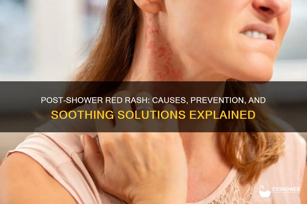 why do i get a red rash after a shower