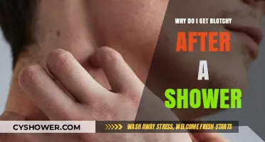 Post-Shower Blotchiness: Causes and Solutions for Sensitive Skin