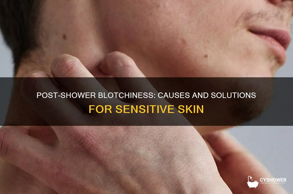 why do i get blotchy after a shower