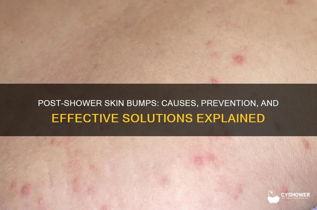 why do i get bumps after i shower