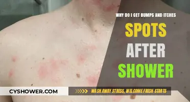 Post-Shower Skin Irritation: Understanding Bumps and Itchy Spots Causes
