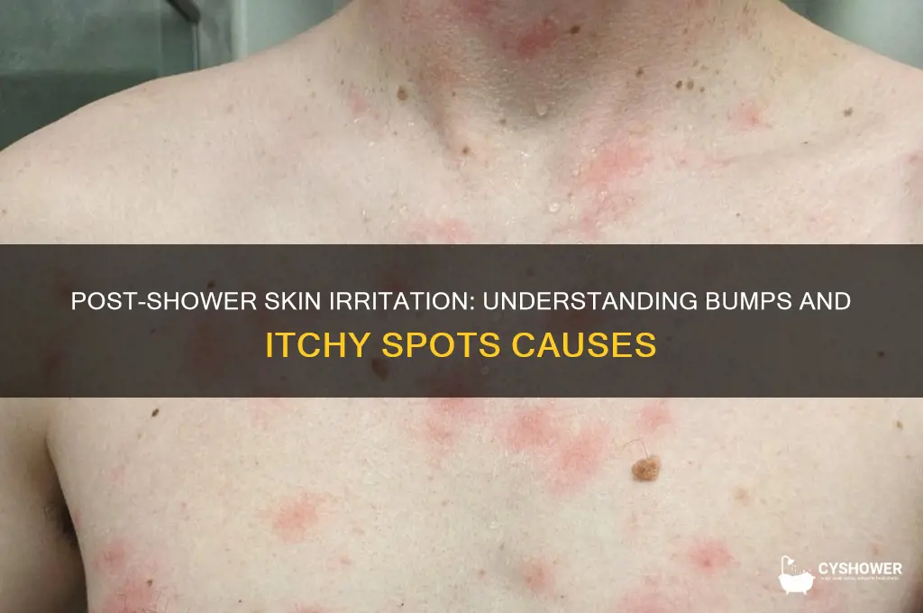 why do i get bumps and itches spots after shower