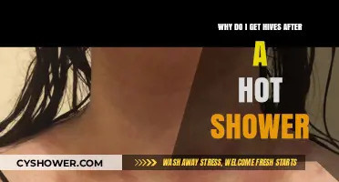 Hot Showers and Hives: Understanding Post-Shower Skin Reactions