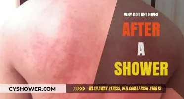 Post-Shower Hives: Causes, Triggers, and Effective Relief Strategies Explained
