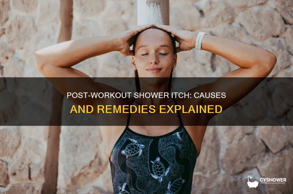 why do i get itchy after a shower post workout