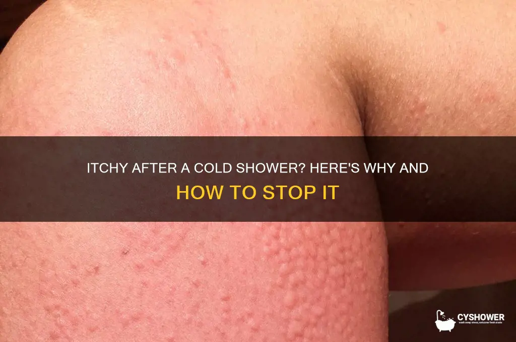 why do i get itchy after cold shower