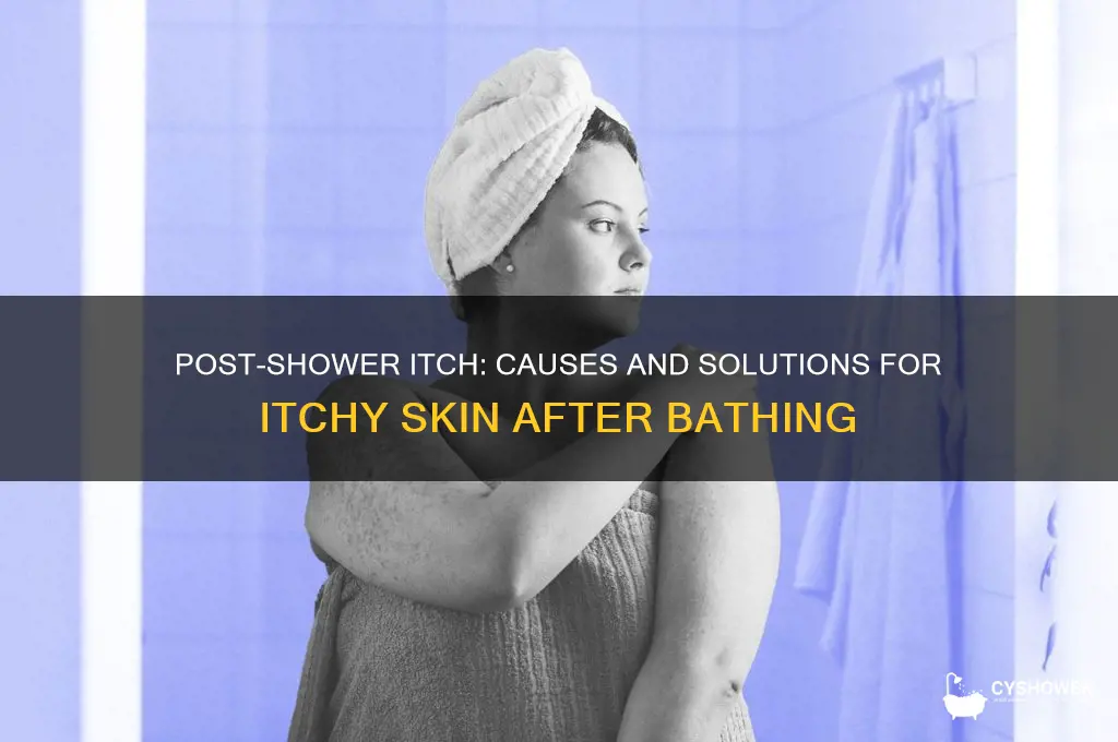 why do i get itchy after i shower