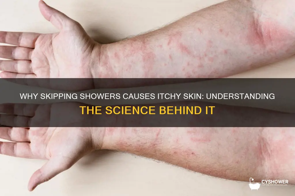 why do i get itchy if i don