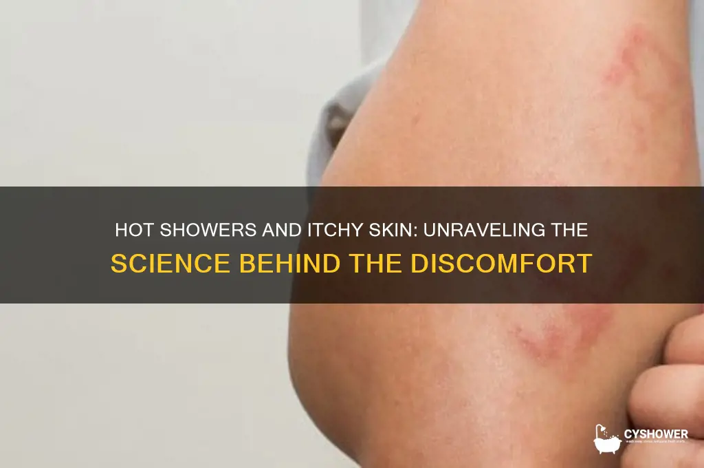why do i get itchy when taking a hot shower
