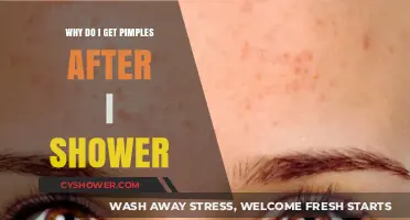 Post-Shower Pimples: Understanding Causes and Preventing Breakouts Effectively