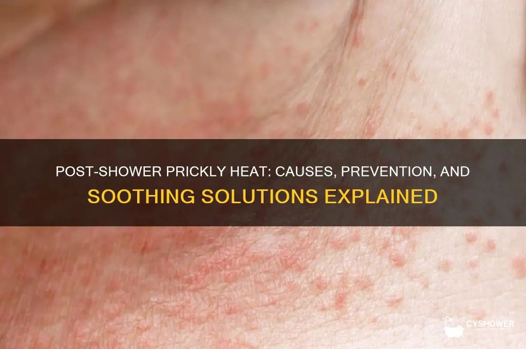 why do i get prickly heat after a shower