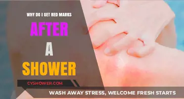 Post-Shower Red Marks: Causes and Solutions for Skin Irritation