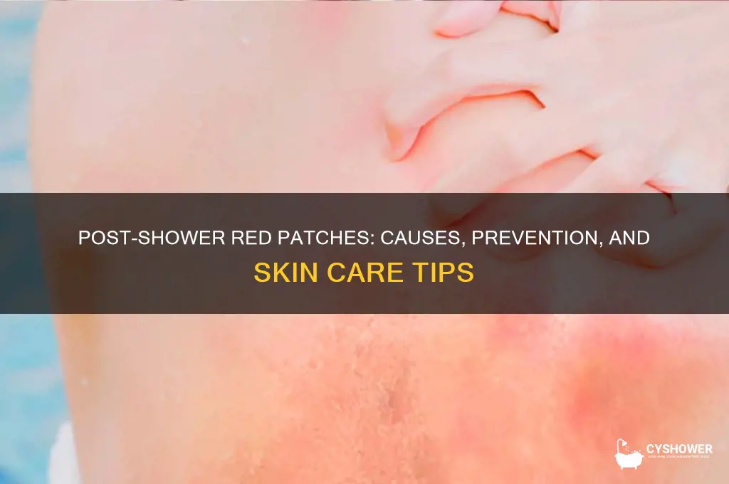 why do i get red patches after a shower
