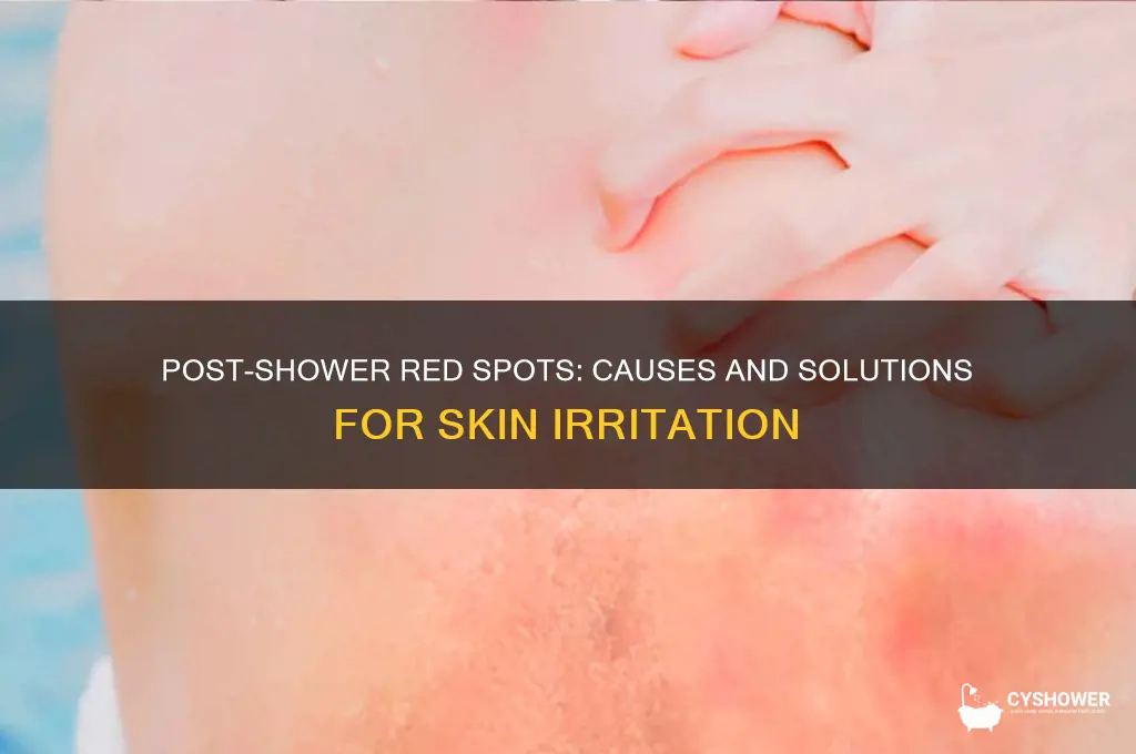 why do i get red spots after i shower