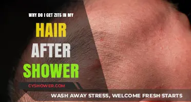 Post-Shower Scalp Zits: Causes and Solutions for Hairline Breakouts
