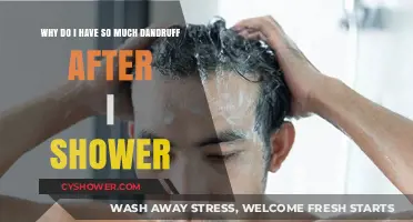 Post-Shower Dandruff Dilemma: Causes and Solutions Explained