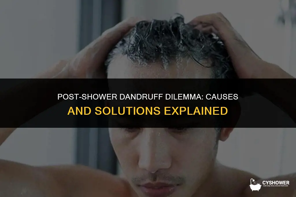why do i have so much dandruff after i shower